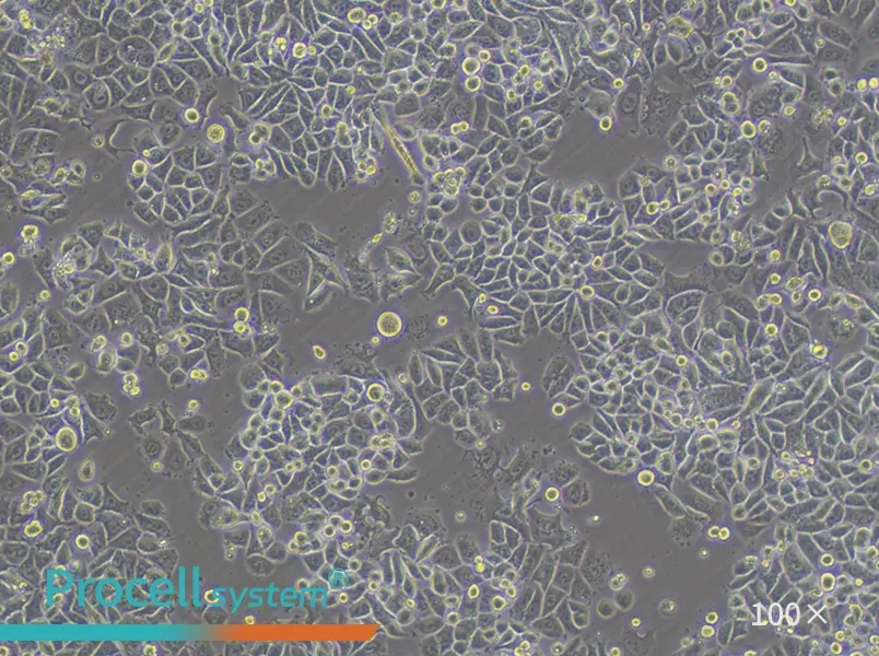 SK-BR-3 [SKBR3] Cell Complete Medium - 1
