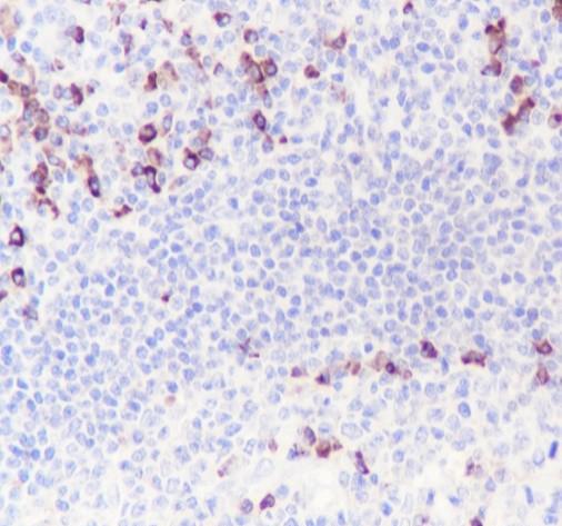 Recombinant Kappa light chain Monoclonal Antibody - 2