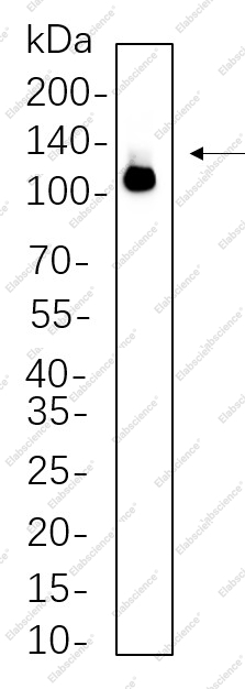 Recombinant DDX58 Monoclonal Antibody - 1