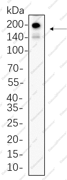 Recombinant PDGFR-α Monoclonal Antibody - 1