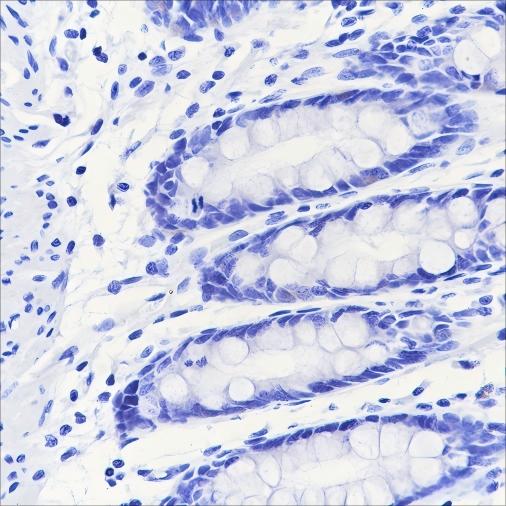Recombinant MAG Monoclonal Antibody - 3