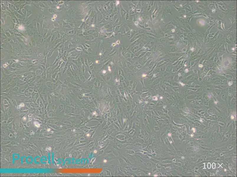 PUMC-HUVEC-T1 Cell Complete Medium - 2