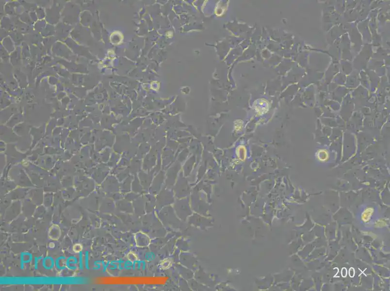 NCI-H322 Cell Complete Medium - 4