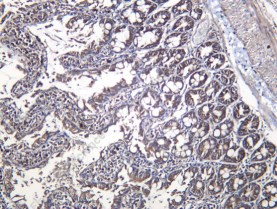 Recombinant ALDH1A2 Monoclonal Antibody - 3