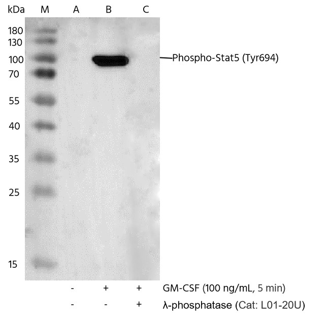 Recombinant Phospho-Stat5 (Tyr694) Monoclonal Antibody - small - 4