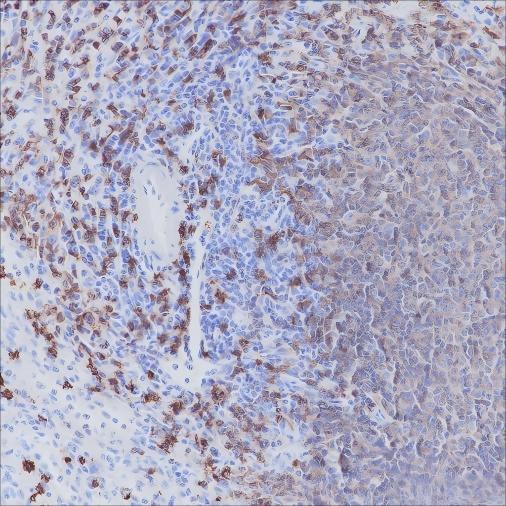 Recombinant CD20 Monoclonal Antibody - small - 2