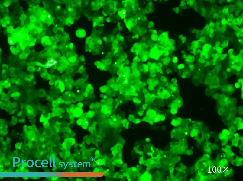 MCF-7-GFP Cell Complete Medium - 1