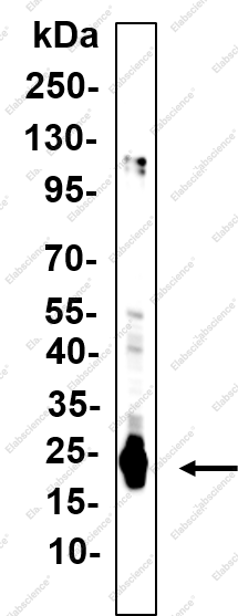 Recombinant SOCS-1 Monoclonal Antibody - 2