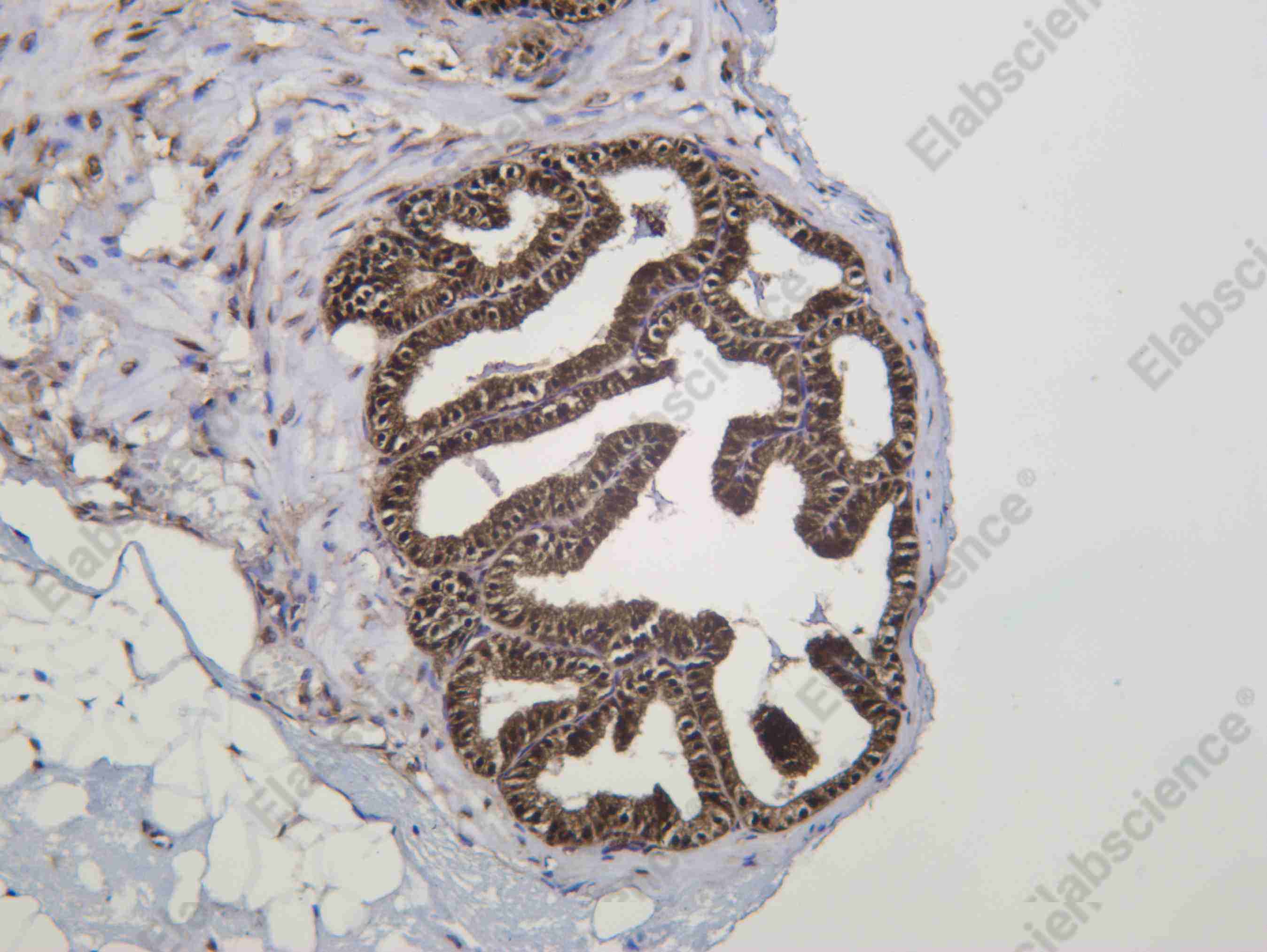 Recombinant BMX Monoclonal Antibody - 2