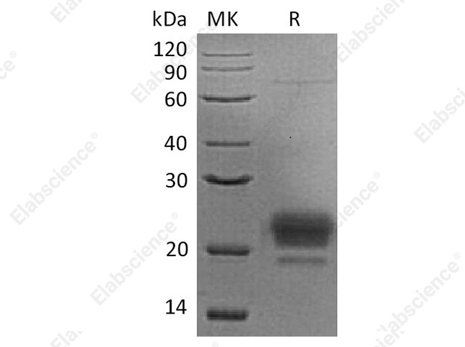 Recombinant Human APOM Protein (His Tag) - 1