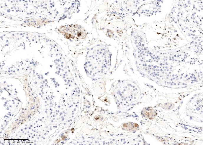 KLK15 Monoclonal Antibody - small - 3