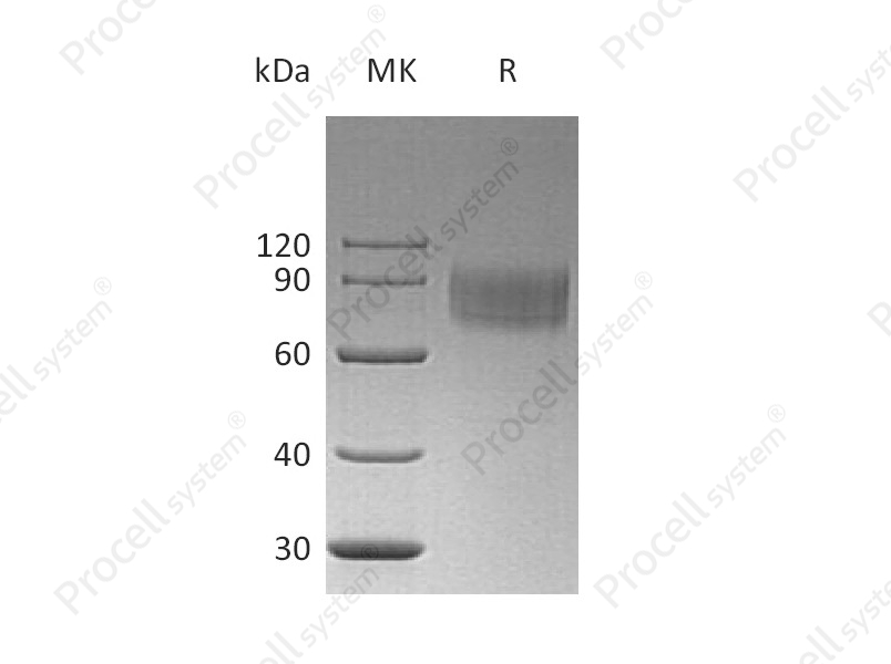 IFNAR1 (C-6His), Human, Recombinant