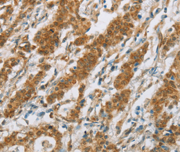 CYP2E1 Polyclonal Antibody - 3
