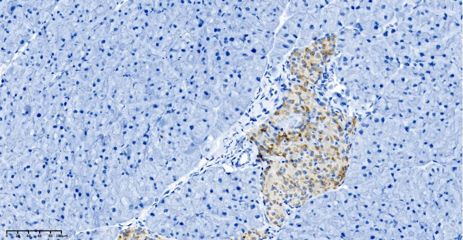 Recombinant Chromogranin A Monoclonal Antibody - small - 4