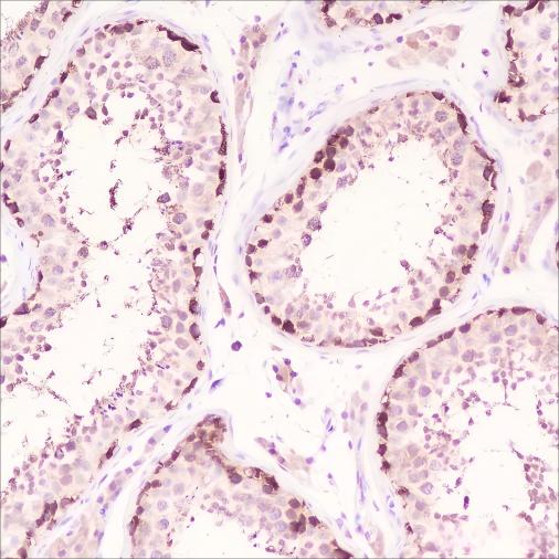 Recombinant HSP90 beta Monoclonal Antibody - small - 2