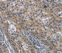 CD160 Polyclonal Antibody - 3