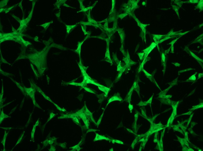 U-87 MG-GFP Cell Complete Medium - 3