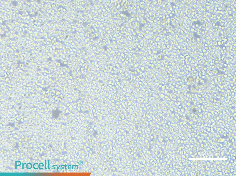 AMO1 Cell Complete MediumAMO1 Cell Complete Medium - 2