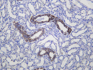 Recombinant Arginase II Monoclonal Antibody - 1
