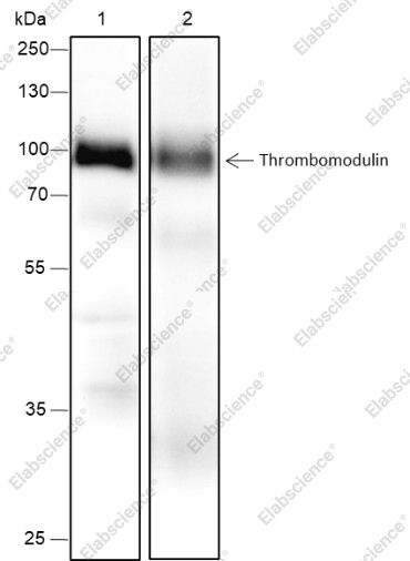 Recombinant Thrombomodulin Monoclonal Antibody - 1