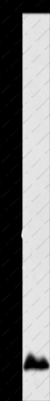 APOC1 Polyclonal Antibody - 1