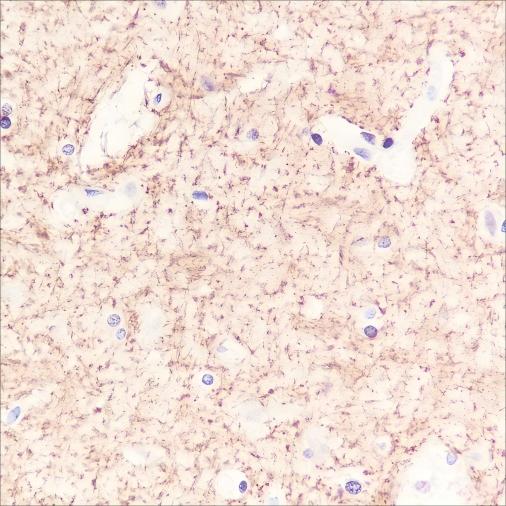 Recombinant SIRT2 Monoclonal Antibody - small - 3