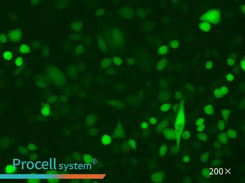 AGS-LUC-EGFP Cell Complete Medium - small - 5