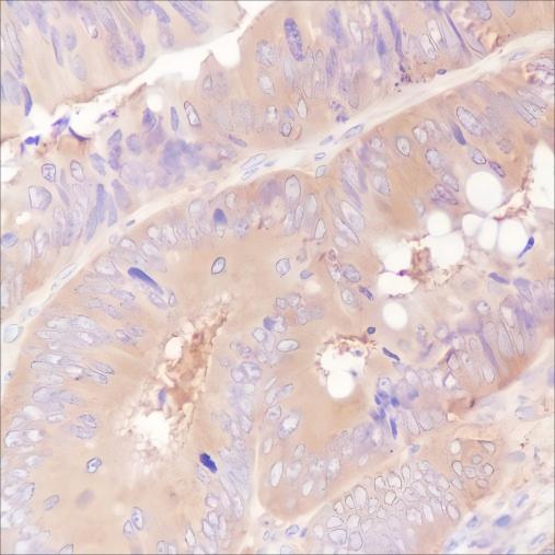 Recombinant ROCK2 Monoclonal Antibody - small - 3