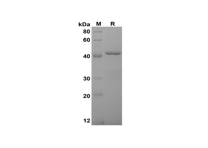 Recombinant Porcine IL-6 Protein(His Tag)-产品推荐-1