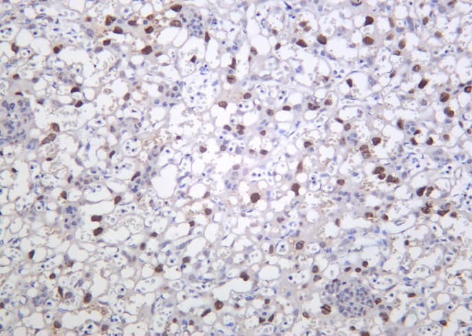 Recombinant PPAR-γ Monoclonal Antibody-searchlist-1