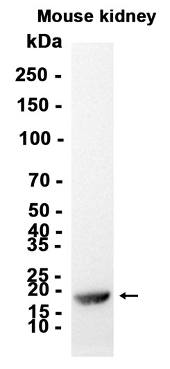 Recombinant Peroxiredoxin 5/PRDX5 Monoclonal Antibody - 2