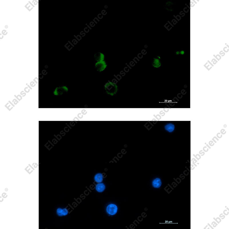 Recombinant Prostaglandin D Synthase Monoclonal Antibody - 2