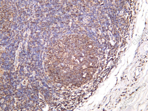 Recombinant PHGDH Monoclonal Antibody - 1