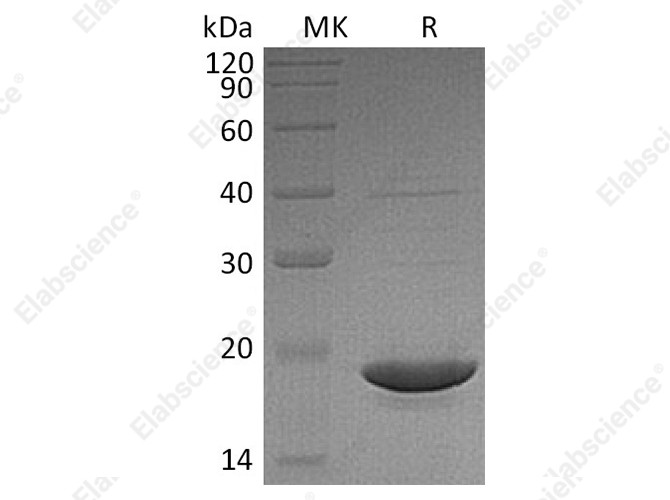 Recombinant Human dUTPase Protein - 1