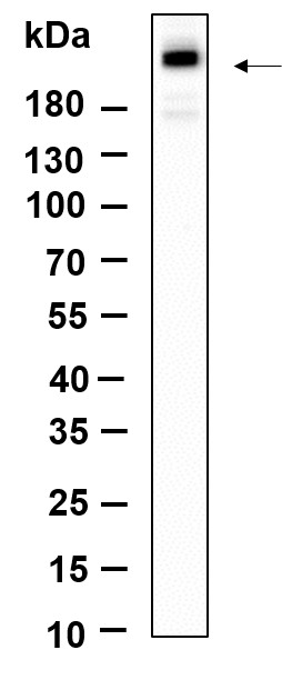 Recombinant Phospho-mTOR (Ser2481) Monoclonal Antibody-searchlist-1