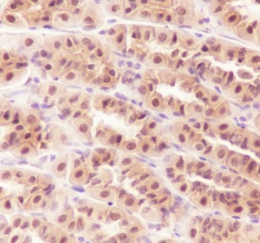 Recombinant RBX1 Monoclonal Antibody - 3