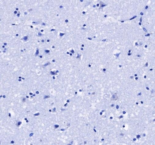 Recombinant FGL1 Monoclonal Antibody - small - 4