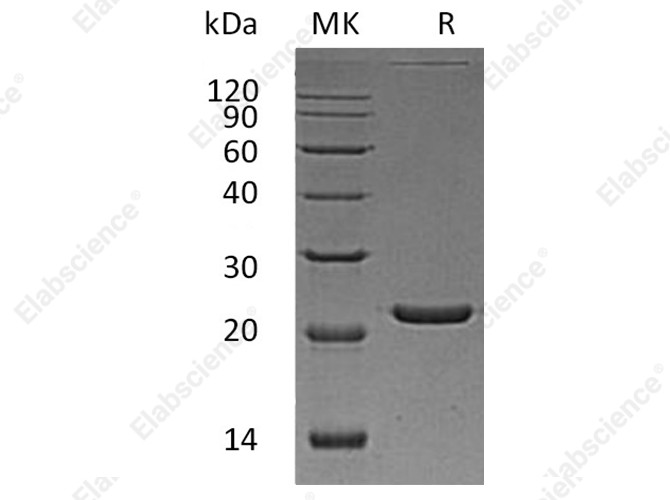 Recombinant Human FTL Protein (His Tag) - 1