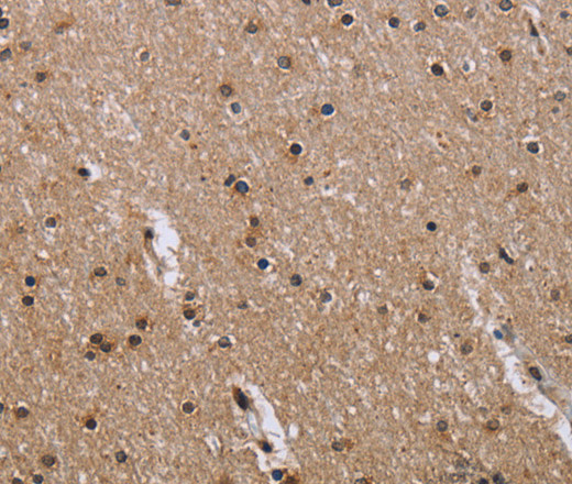 Immunohistochemistry of paraffin-embedded Human brain  using GAB2 Polyclonal Antibody at dilution of 1:50