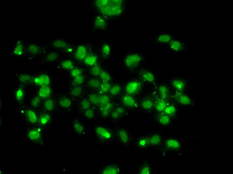 Immunofluorescence analysis of A-549 cells using WBSCR22 Polyclonal Antibody