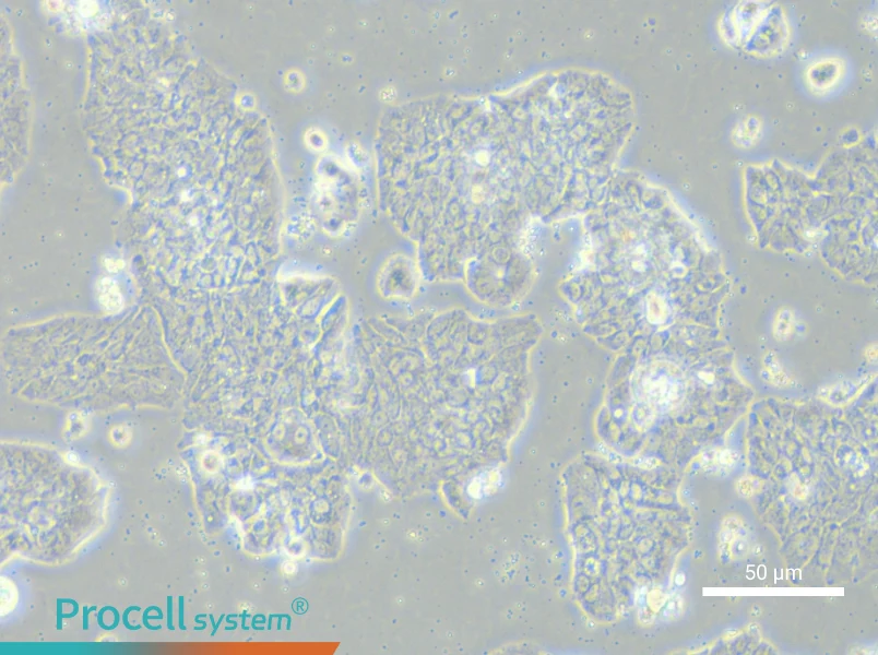 HCC1500 Cell Complete MediumHCC1500 Cell Complete Medium - 5