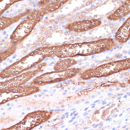 Immunohistochemistry of paraffin-embedded rat kidney using GEMIN5 Polyclonal Antibody at dilution of 1:100 (40x lens).Perform microwave antigen retrieval with 10 mM PBS buffer pH 7.2 before commencing with IHC staining protocol.