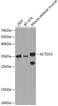 Western blot analysis of extracts of various cell lines using KCTD15 Polyclonal Antibody at 1:1000 dilution.