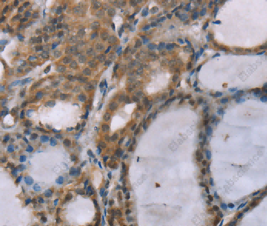 ACTN2 Polyclonal Antibody - 3