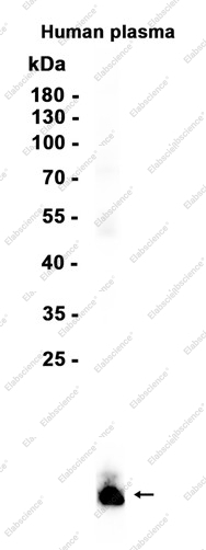 Recombinant Apolipoprotein CIII Monoclonal Antibody - 1