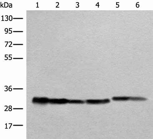 Western blot analysis of Human heart tissue A549 231 Jurkat HEPG2 and Hela cell lysates  using ATP5C1 Polyclonal Antibody at dilution of 1:1000