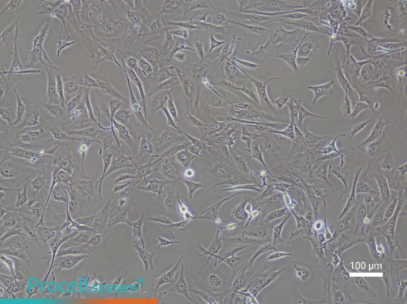 Mouse Prostate Fibroblast Complete Medium - 2