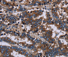 JAM-A Polyclonal Antibody - 2