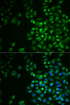 Immunofluorescence analysis of MCF7 cells using POLG2 Polyclonal Antibody