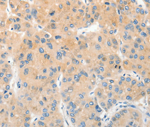 RPN1 Polyclonal Antibody - 2